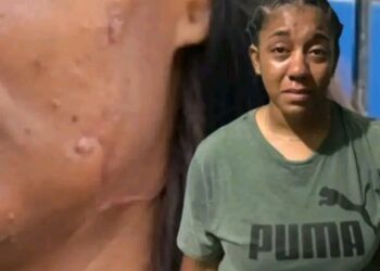 Juez dispone libertad bajo fianza a mujer acusada de agresión con arma blanca en Samaná