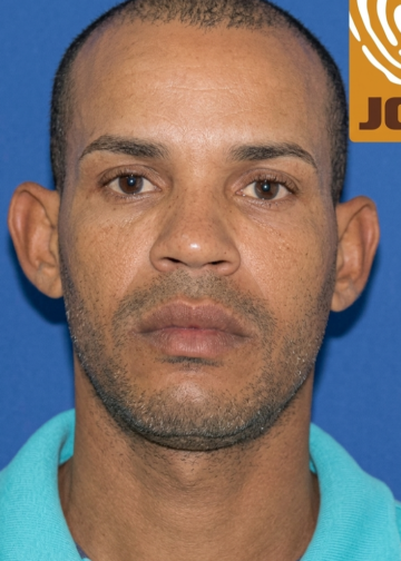 DICRIM activa búsqueda de presunto autor de homicidio en Las Terrenas